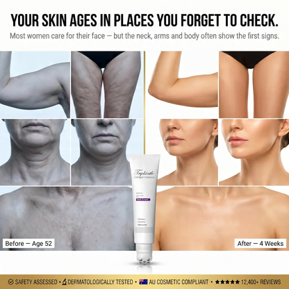 WARNING: Only 3 Units Left — The #1 Collagen Roller Cream for Sagging Skin on Neck, Arms, Thighs & Full Body | 4-Week Results